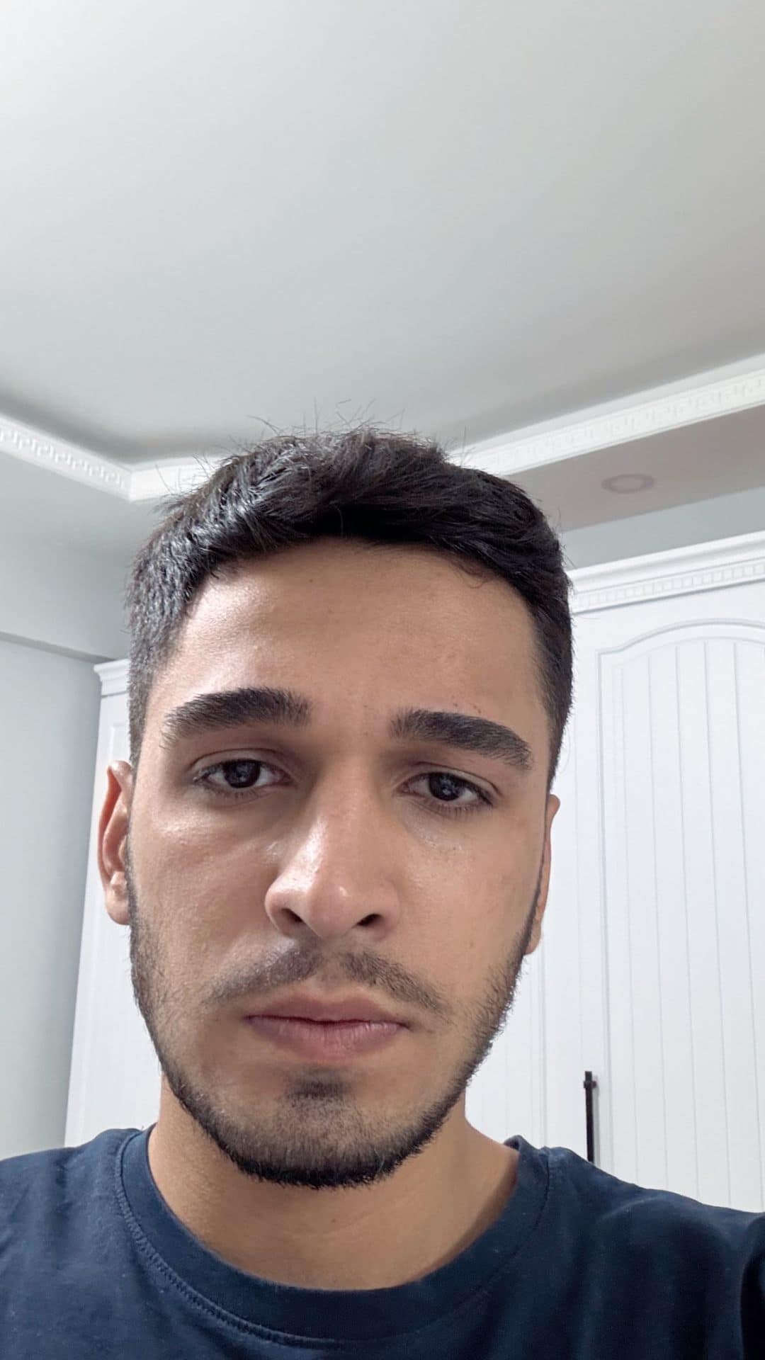 Antes